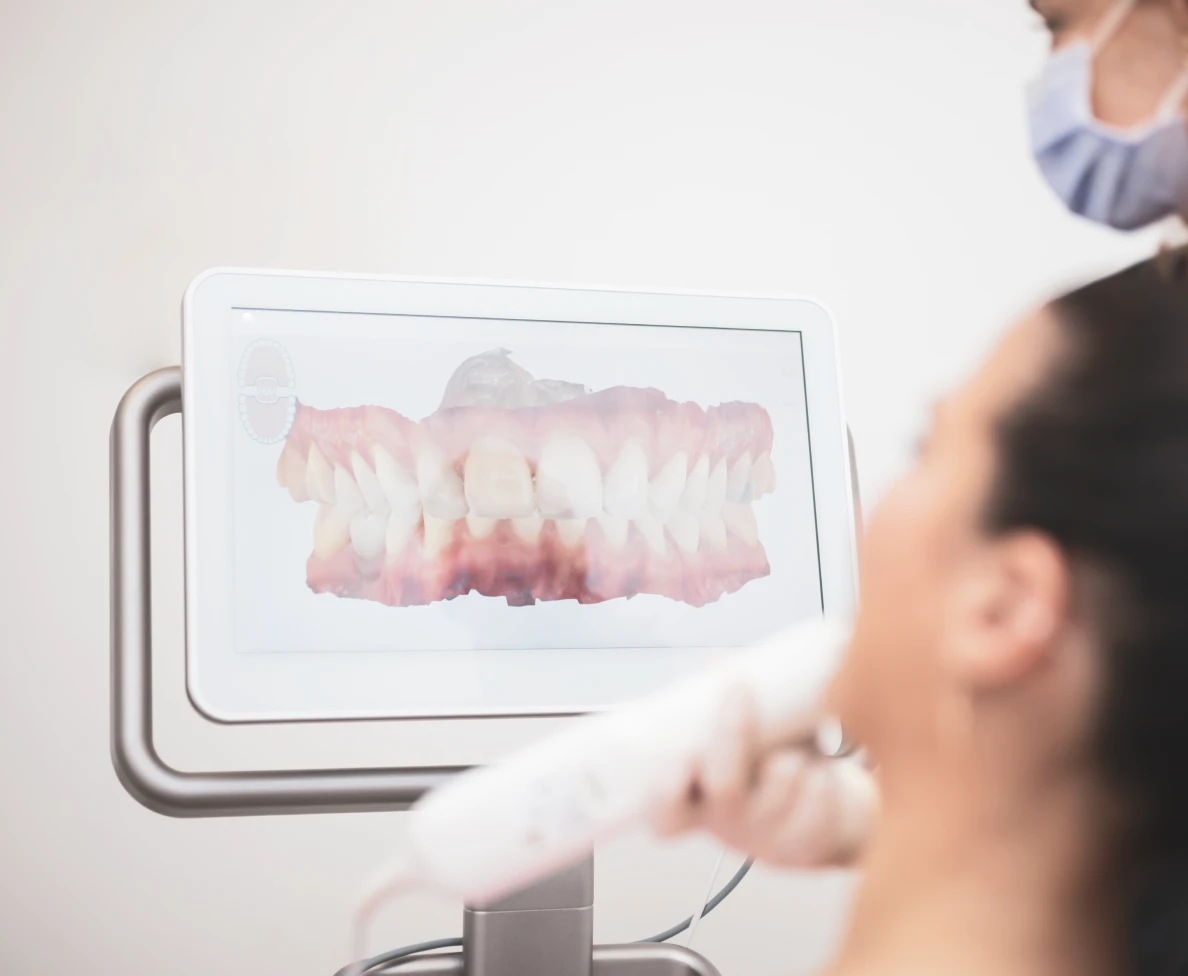 Prise d'empreinte numérique des dents au cabinet dentaire Arcadia à Quingey