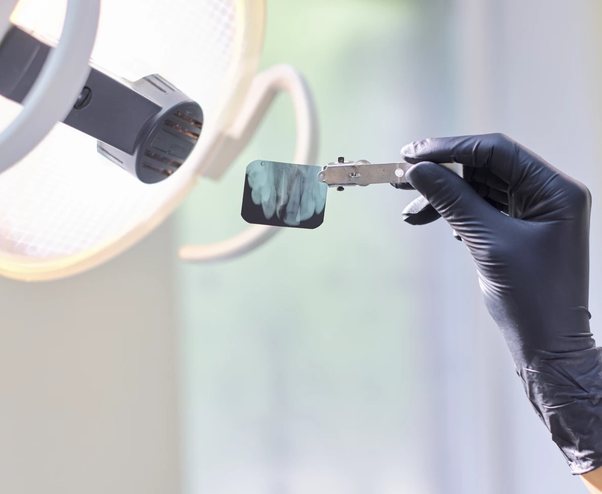 Capteur de radiographie rétro-alvéolaire utilisé au cabinet dentaire Arcadia à Quingey