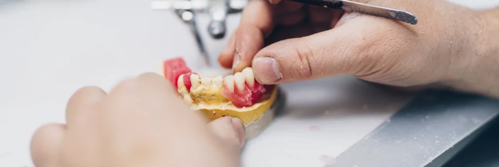 Fabrication d'une prothèse dentaire sur mesure en laboratoire